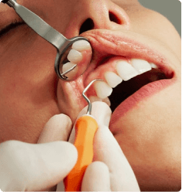 Placeholder imageScaling and Prophylaxis